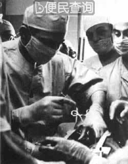 南非医生巴纳德首次将第二颗心脏植入人体获成功